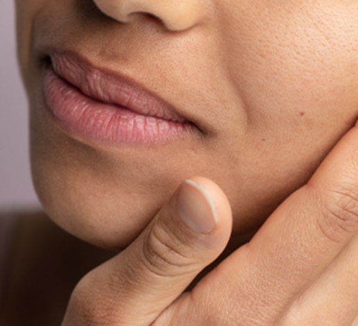 Dehydration Skin