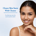 Load image into Gallery viewer, Avitha Purifying Anti Acne Face Wash